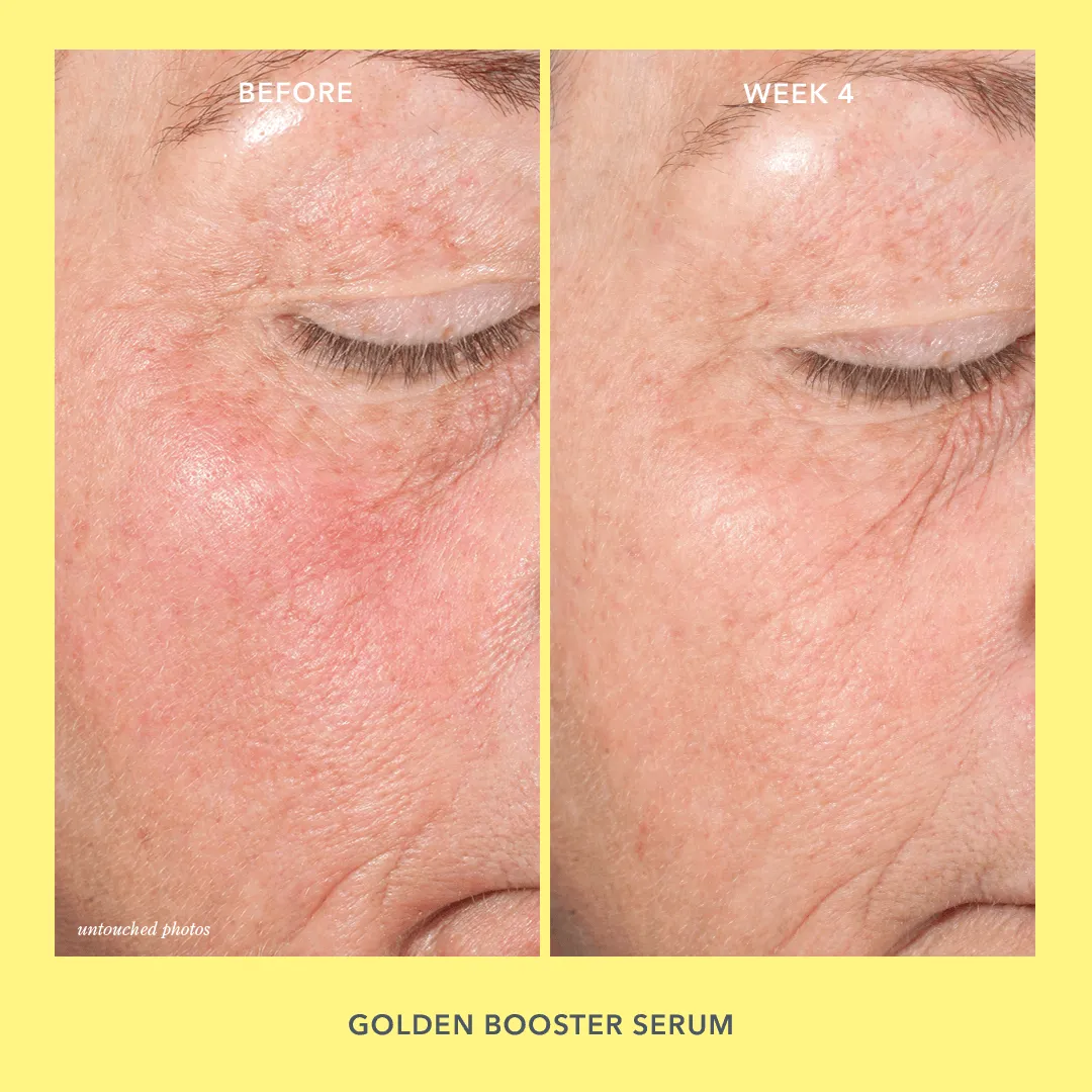 Golden Booster Amla Berry Vitamin C Brightening Serum